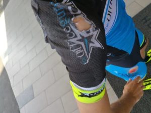 The damage done to Dylan Girdlestone's shoulder
