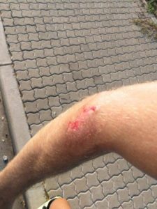 Dylan Girdlestone suffered a high impact collision with a car